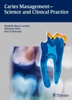 Lage Prijs Caries Management - Science and Clinical Practice