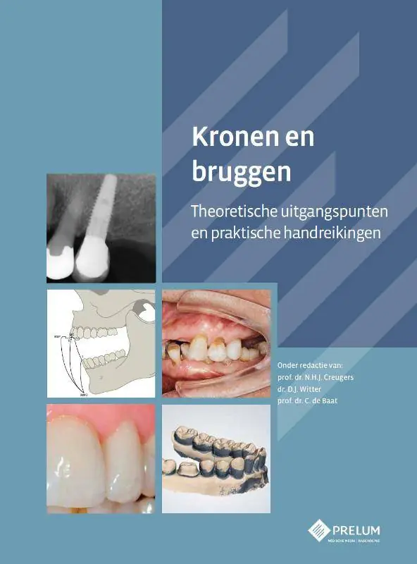 Kronen en bruggen / Druk 1 Op = Op