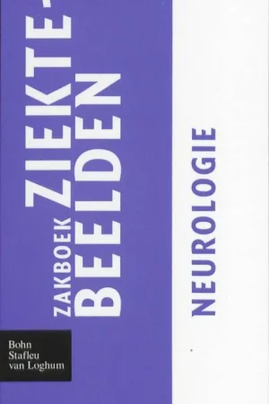 Zakboek ziektebeelden Neurologie / Druk 1 Voordeelprijs