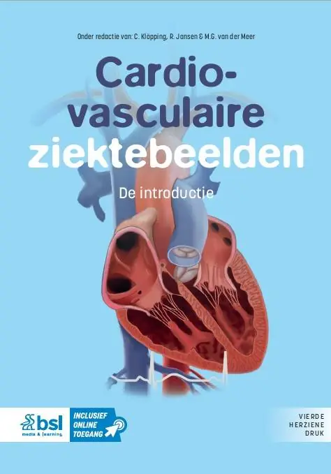 Goedkoop Cardiovasculaire ziektebeelden / Druk 4