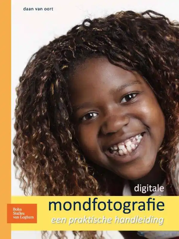 Digitale mondfotografie / Druk 1 Lage Kosten